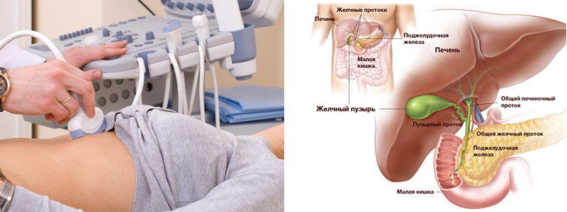 УЗИ желчного пузыря