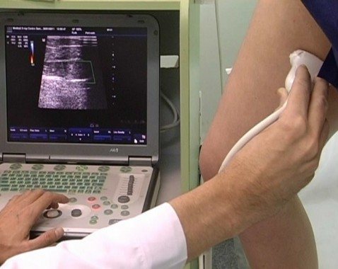 УЗИ сосудов нижних конечностей