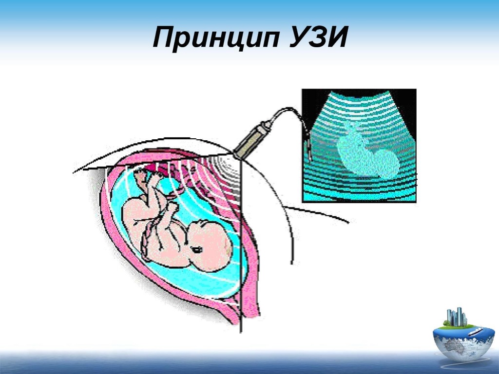 Изображение при узи получают